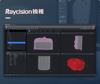 銳視醫(yī)療CT分析軟件界?設(shè)計